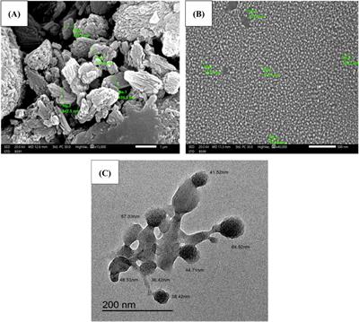 Chitosan/hesperidin nanoparticles formulation: a promising approach against ethanol-induced gastric ulcers via Sirt1/FOXO1/PGC-1α/HO-1 pathway